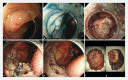 Fig. 2 a
