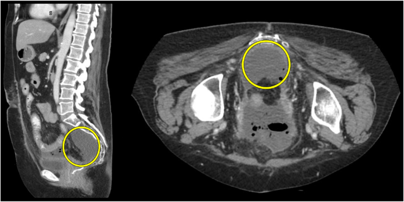 Figure 2