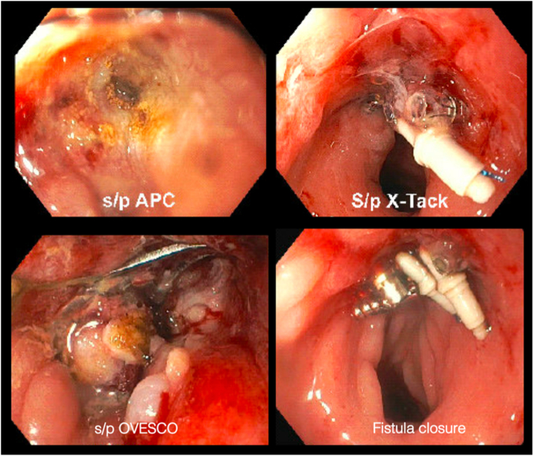 Figure 4