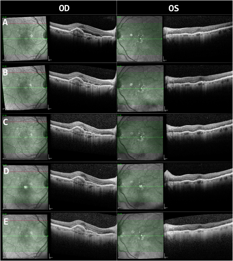 Fig. 1