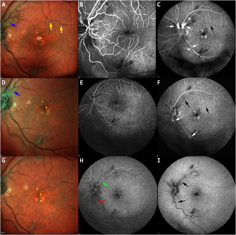 Fig. 3