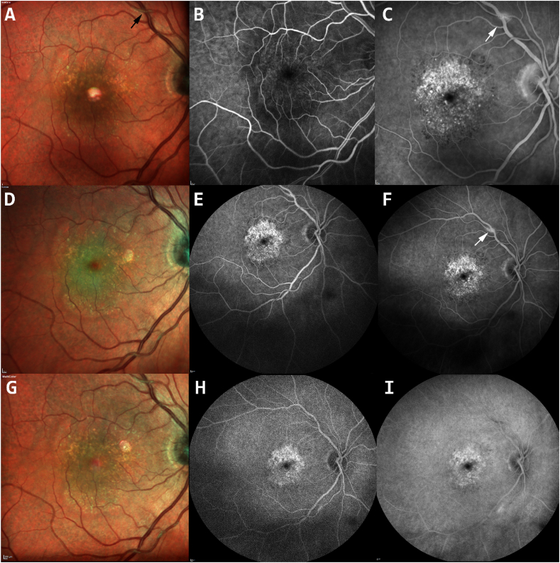 Fig. 2