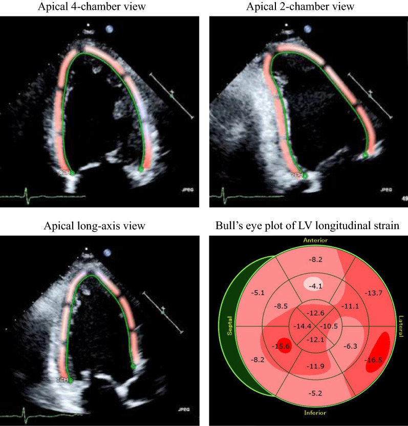 Fig. 1