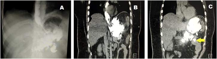 Fig. 1