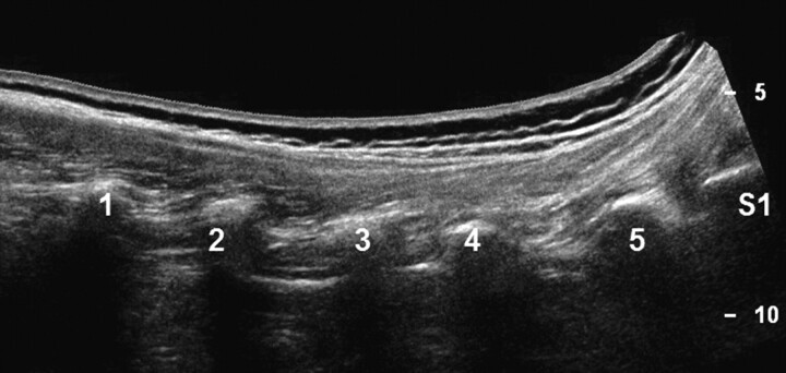 Fig 3.