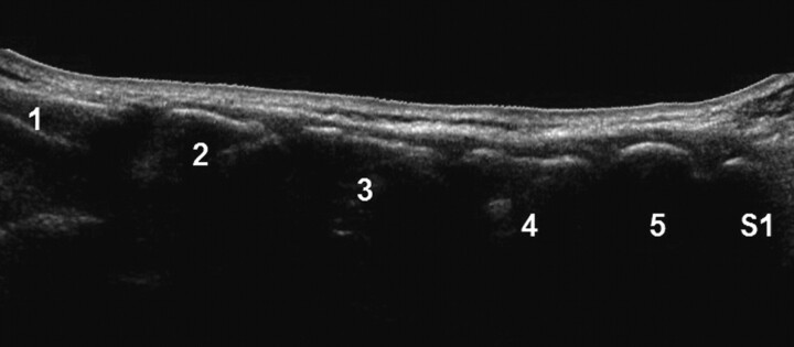 Fig 1.