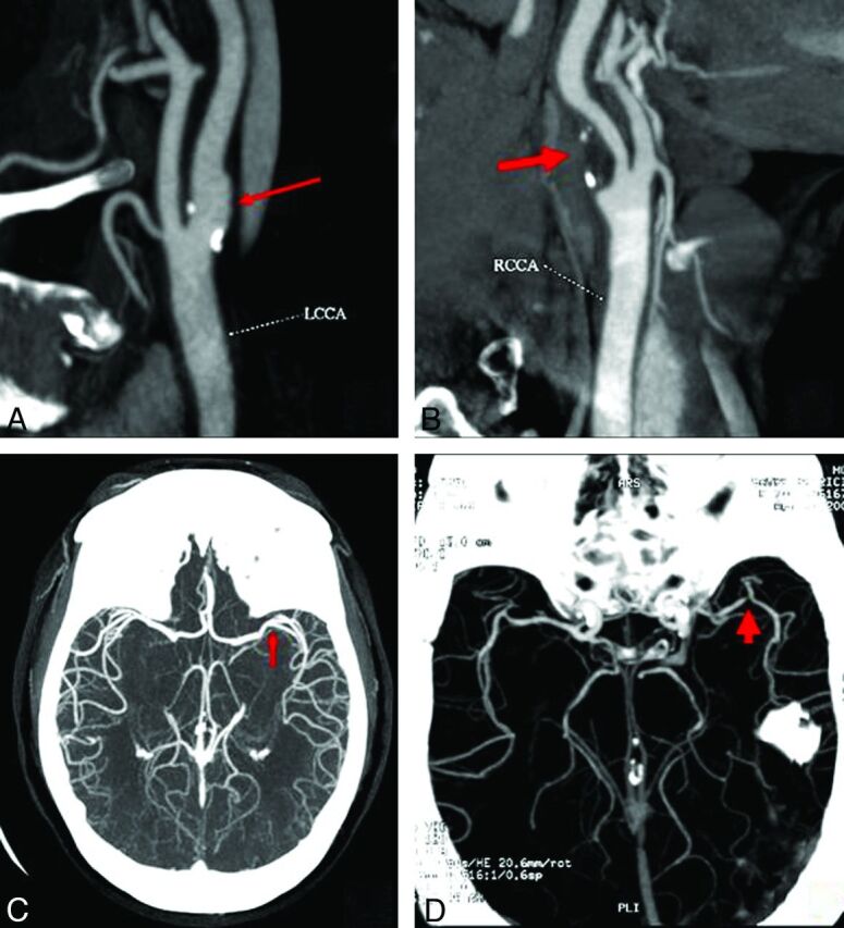 Fig 1.