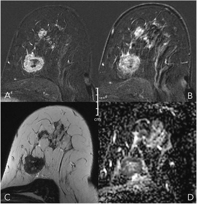 Fig. 12