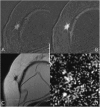 Fig. 11