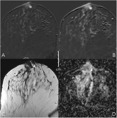 Fig. 9