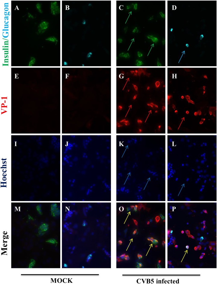 Figure 11.