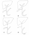 Figure 1)