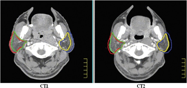 Fig. 2.