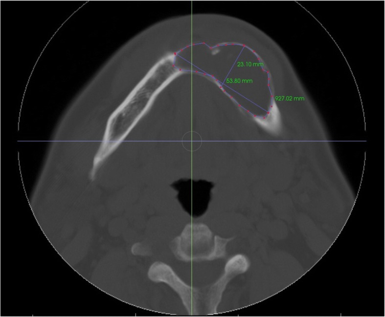 Fig. 2