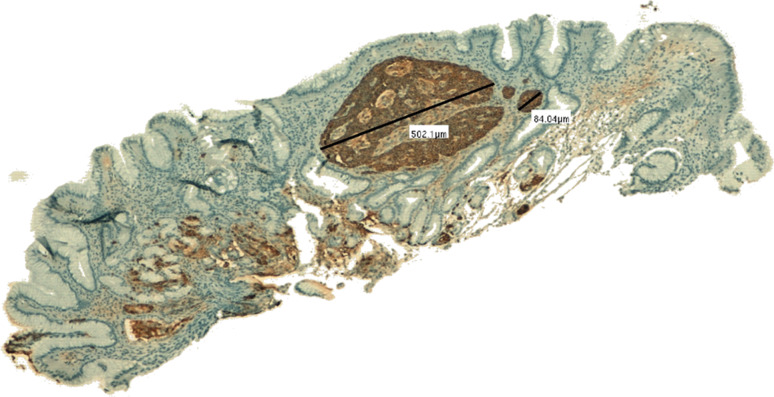 Fig. 1