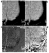 Fig. (10)