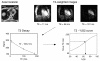 Fig. (1)