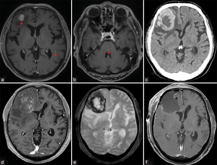 Figure 2: