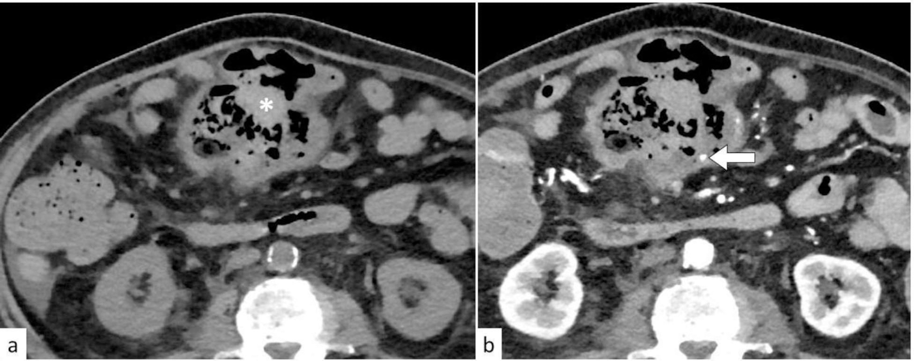 Fig. 6: