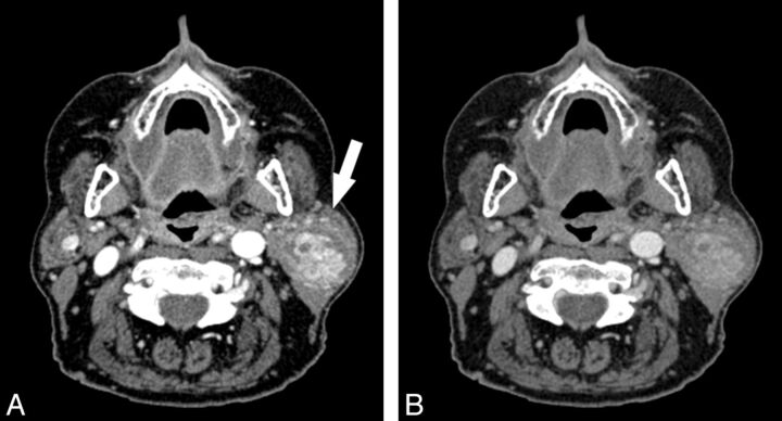 Fig 2.