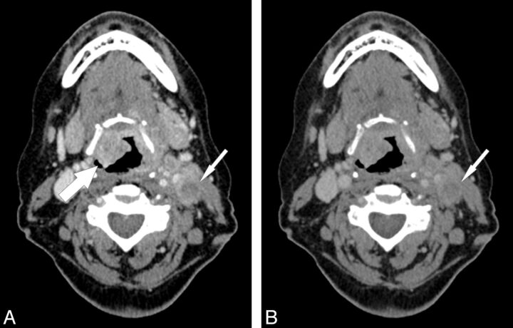 Fig 1.