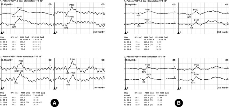 Fig. 4