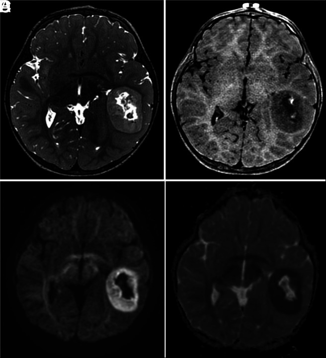 FIG 2.