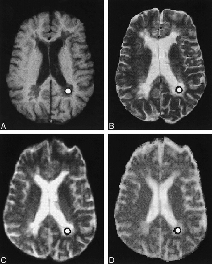 fig 1.