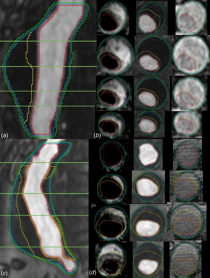 Fig. 2