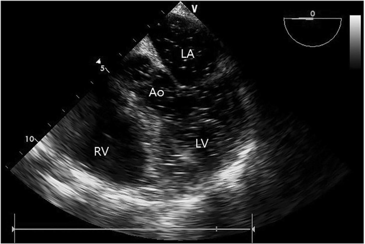 Fig. 2