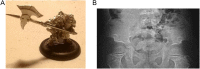 Fig. 10