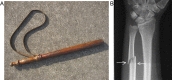 Fig. 11