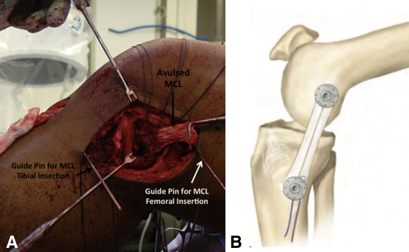 Fig 14