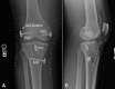 Fig 16