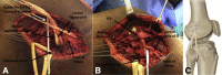 Fig 13