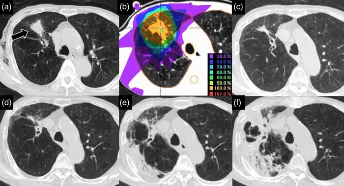 Fig. 6.