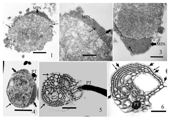 Fig. 1–6