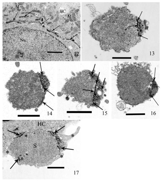 Fig. 12–17