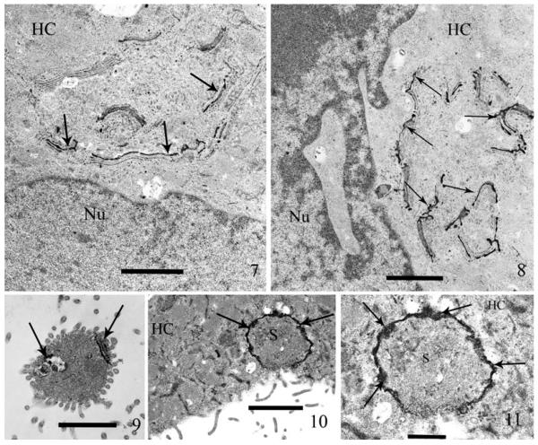 Fig. 7–11