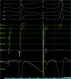 Supplementary Figure 1