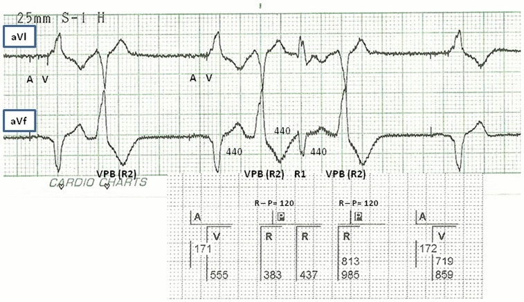 Figure 2