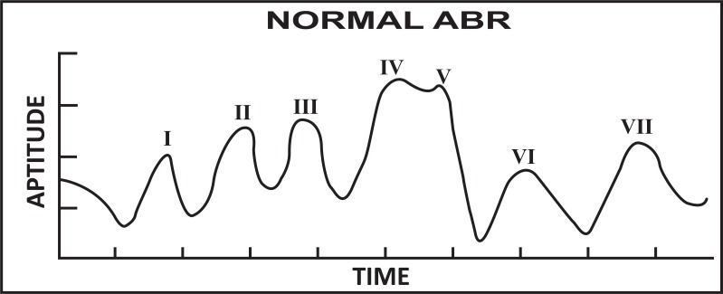 Fig. (1)