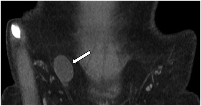 Fig. 10.