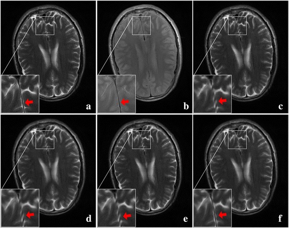 Fig. 10