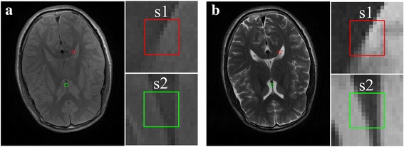 Fig. 6