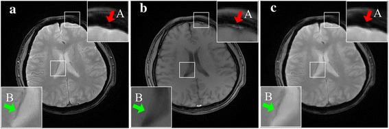 Fig. 12