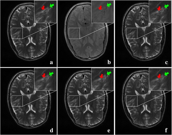 Fig. 11