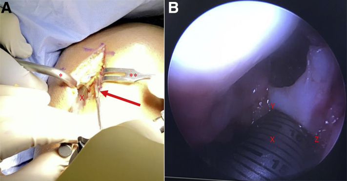 Fig 6