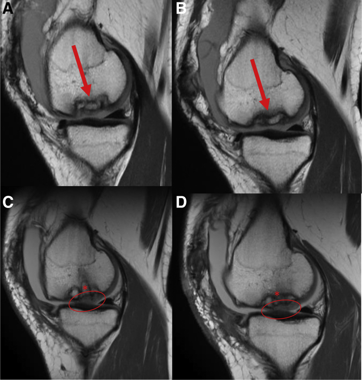 Fig 17