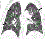 FIGURE 11.